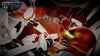 Metroid Dread (Switch)